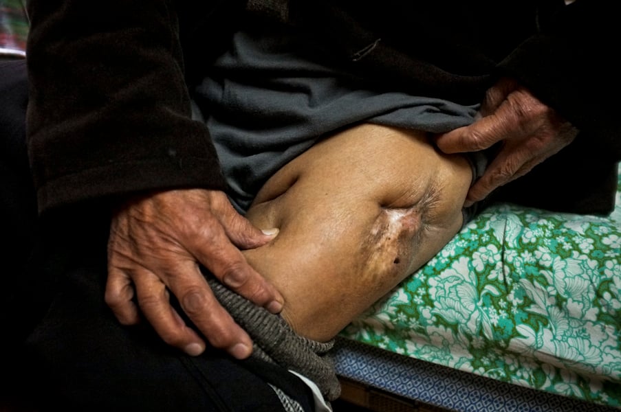 Amanda Mustard's photograph of a survivor's wounds