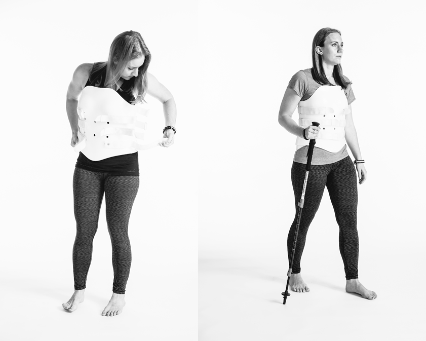 side-by-side portraits of Amber putting on her back brace (left) and walking with a walking stick (right) against a white background