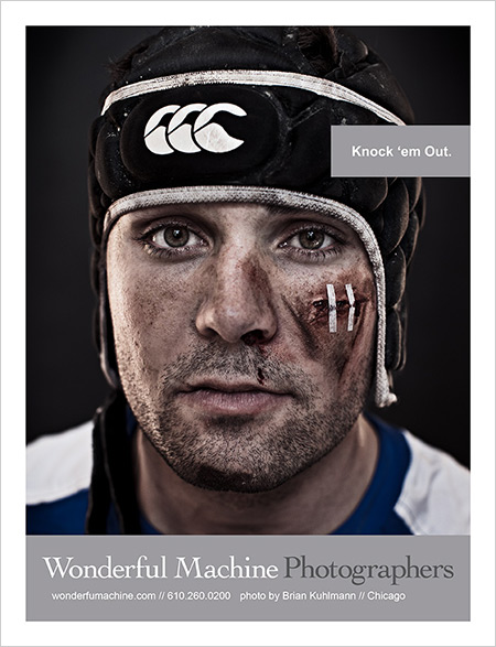 Brian Kuhlmann's photo of beat-up rugby player, knock 'em out