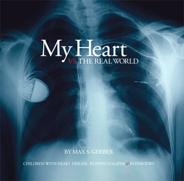 Cover of LA-based kids photographer Max S. Gerber's book, My Heart vs. The Real World. 
