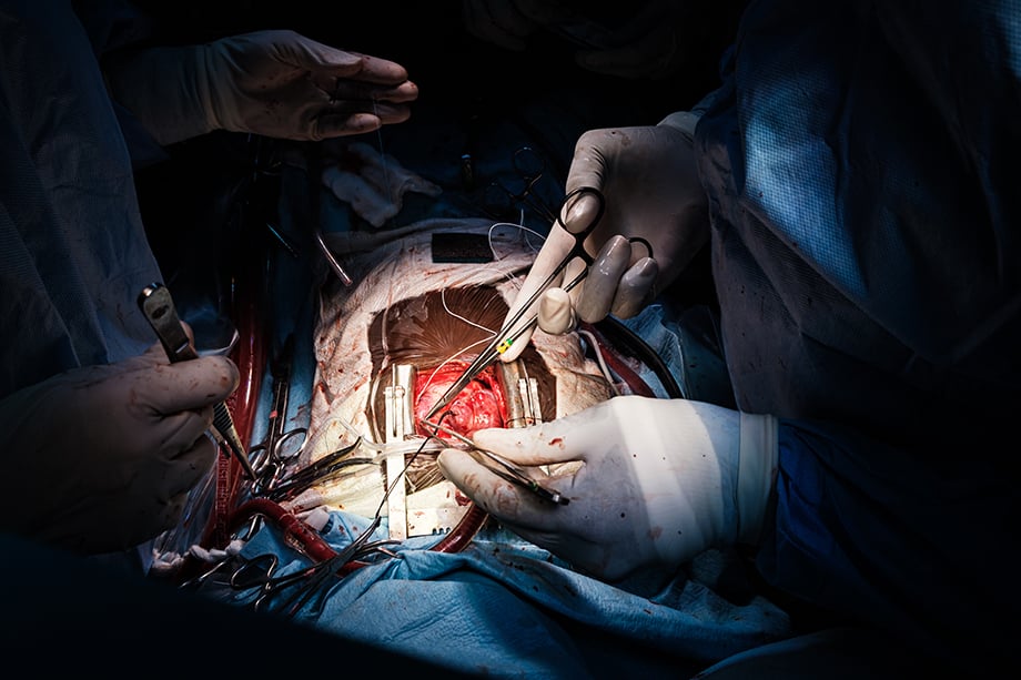 Heart surgery by Roberto Morelli