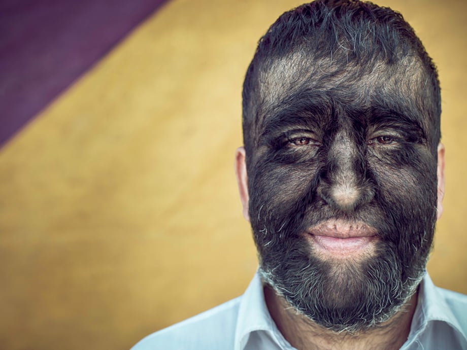 Portrait of "wolf boy" Jesus (who has hypertrichosis) by photographer Cade Martin in Tulum, Mexico