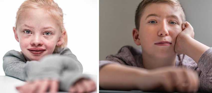 Portraits of two of the kids who have survived severe medical treatments, photo by Michael Schoenfeld.